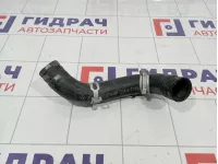 Патрубок радиатора Hyundai Elantra (AD) 25415-F2100